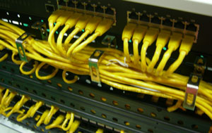 Cable Management - SET 